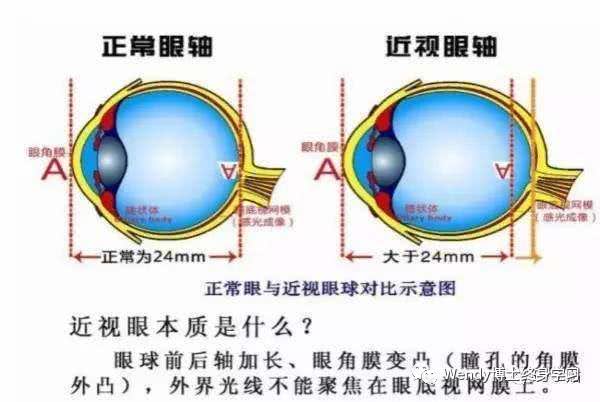 治眼睛近视费用